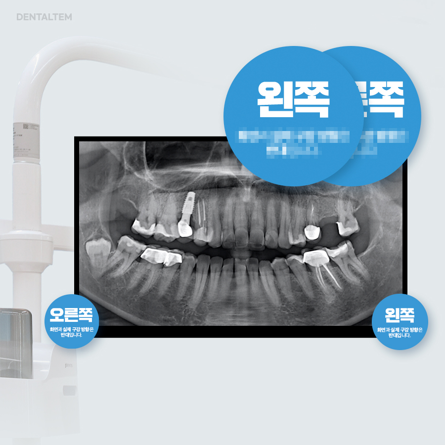 파노라마 안내 스티커(좌,우)