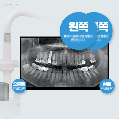 파노라마 안내 스티커(좌,우)