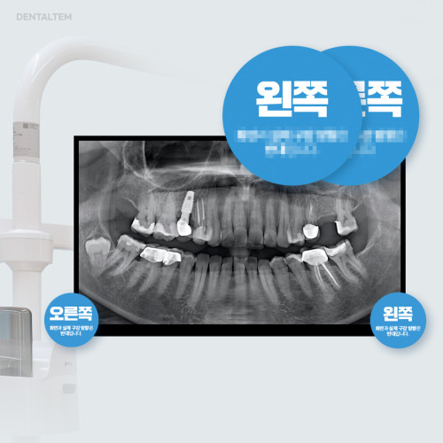파노라마 안내 스티커(좌,우)