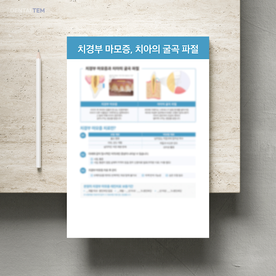 치경부 마모증, 치아의 굴곡 파절