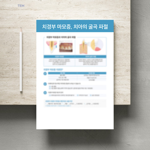 치경부 마모증, 치아의 굴곡 파절